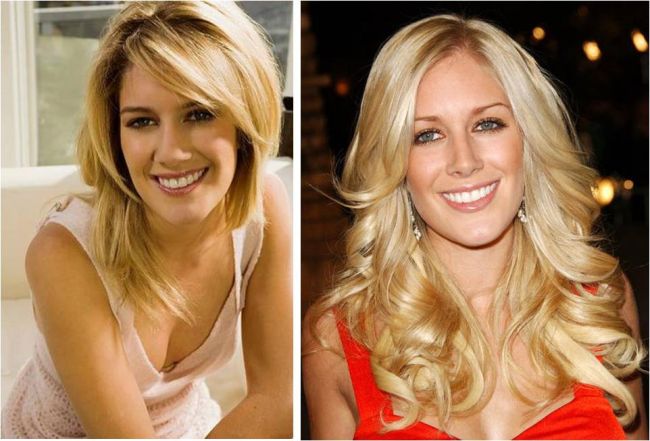 heidi montag before plastic surgery. heidi montag after surgery.