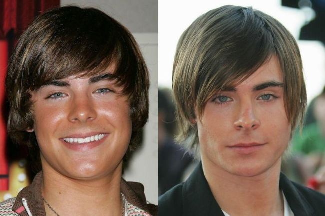 Celebrities Before and After Plastic Surgery and Photoshop!