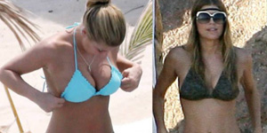 Celebrities Botox Before and After